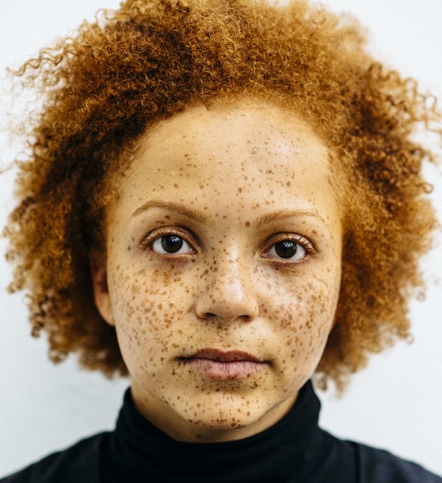 african americans with red hair