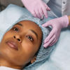 A woman is getting Botox and fillers applied on her forehead